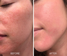 Load image into Gallery viewer, Lumiellè Glass Skin Liquid Exfoliant