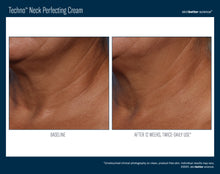 Load image into Gallery viewer, SkinBetter Techno Neck Cream