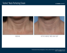 Load image into Gallery viewer, SkinBetter Techno Neck Cream