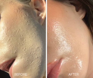 Lumiellè Glass Skin Liquid Exfoliant